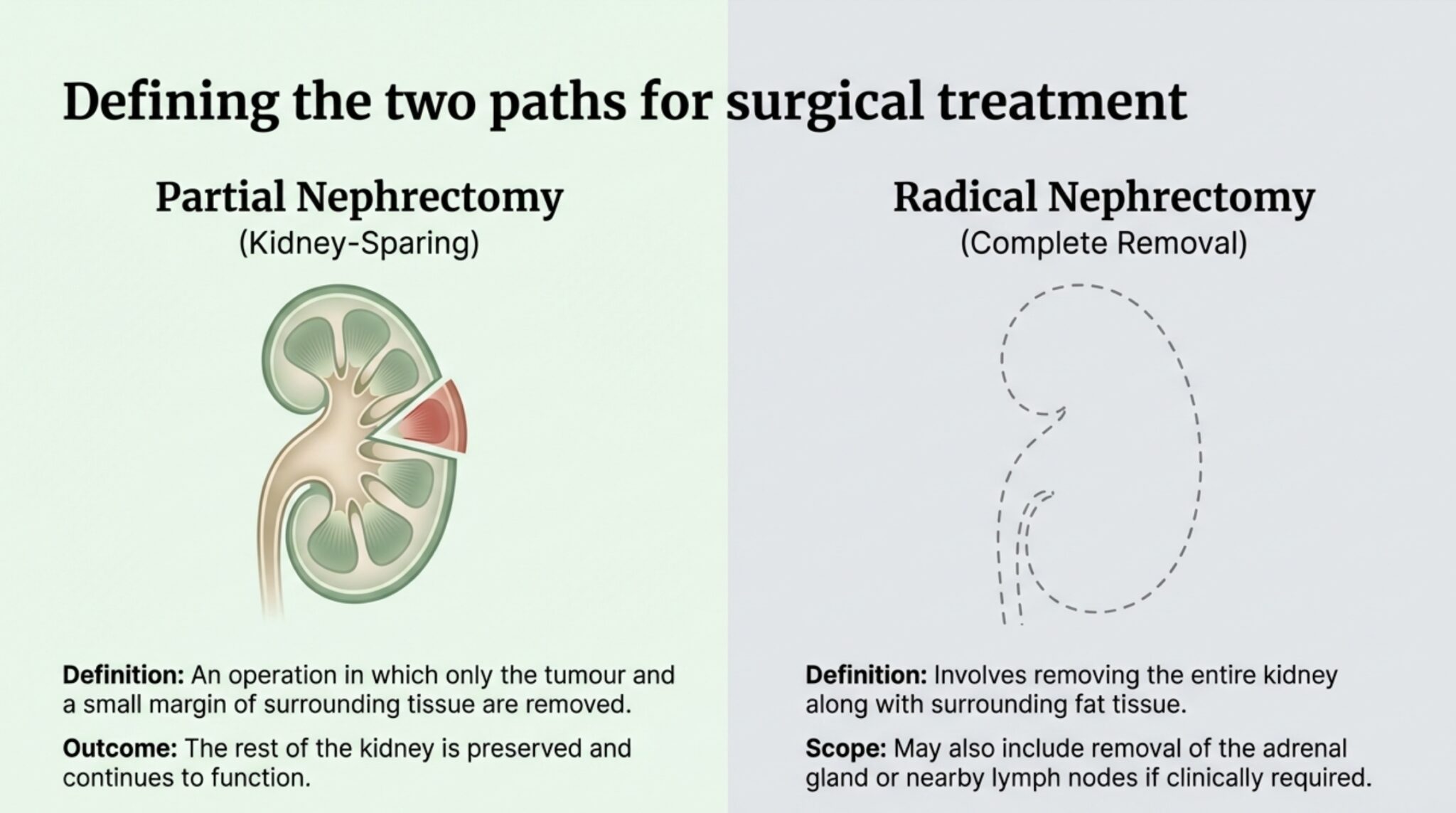 Partial vs Radical Nephrectomy | Robotic Kidney Surgery by Dr Zaheen Khan