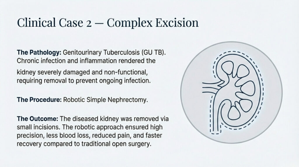 A Major Milestone for Purnea and UKM Hospital: Three Robotic Surgeries Successfully Performed in a Single Day